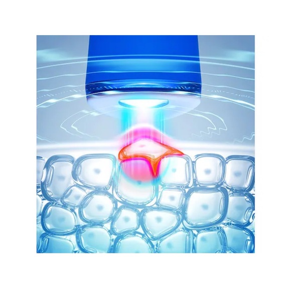 FOREO ESPADA - Picture 3 of 7